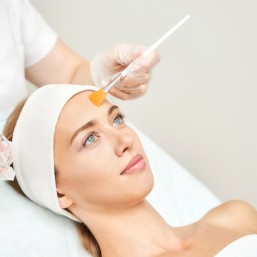 Chemical peels