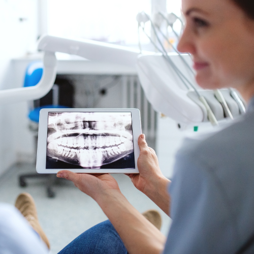 DIGITAL X-RAY, DENTAL IMPLANTS