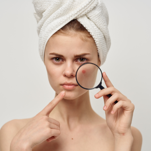 Open pores