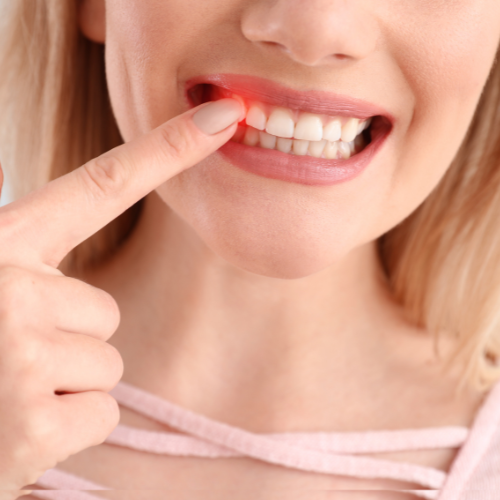 GUM INFLAMMATION TREATMENT